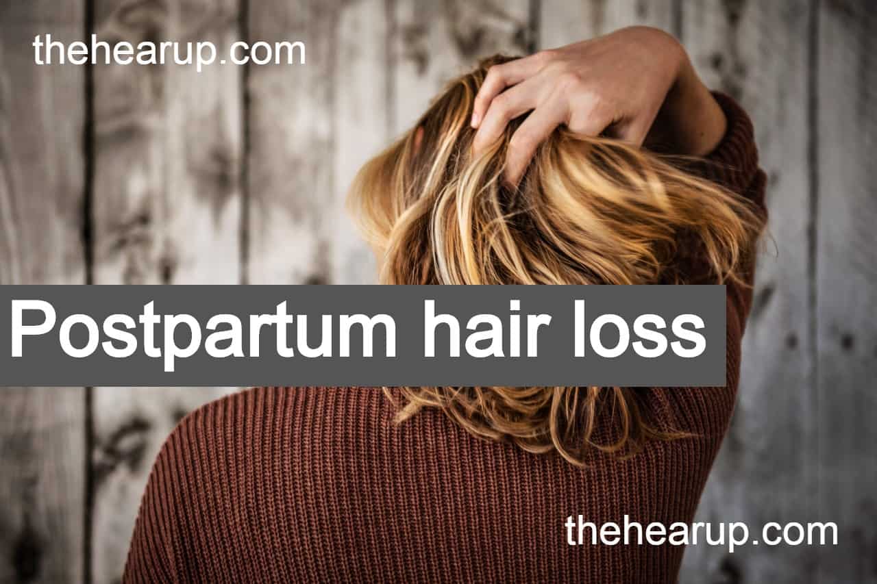 Postpartum hair loss