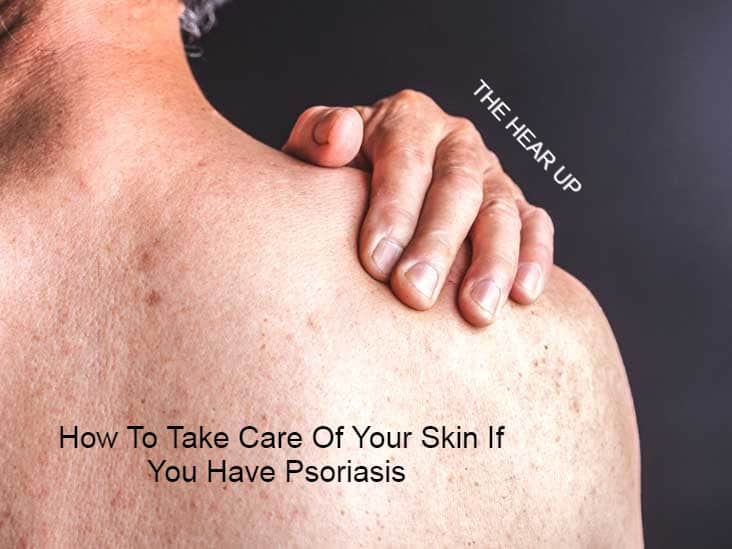 How To Take Care Of Your Skin If You Have Psoriasis