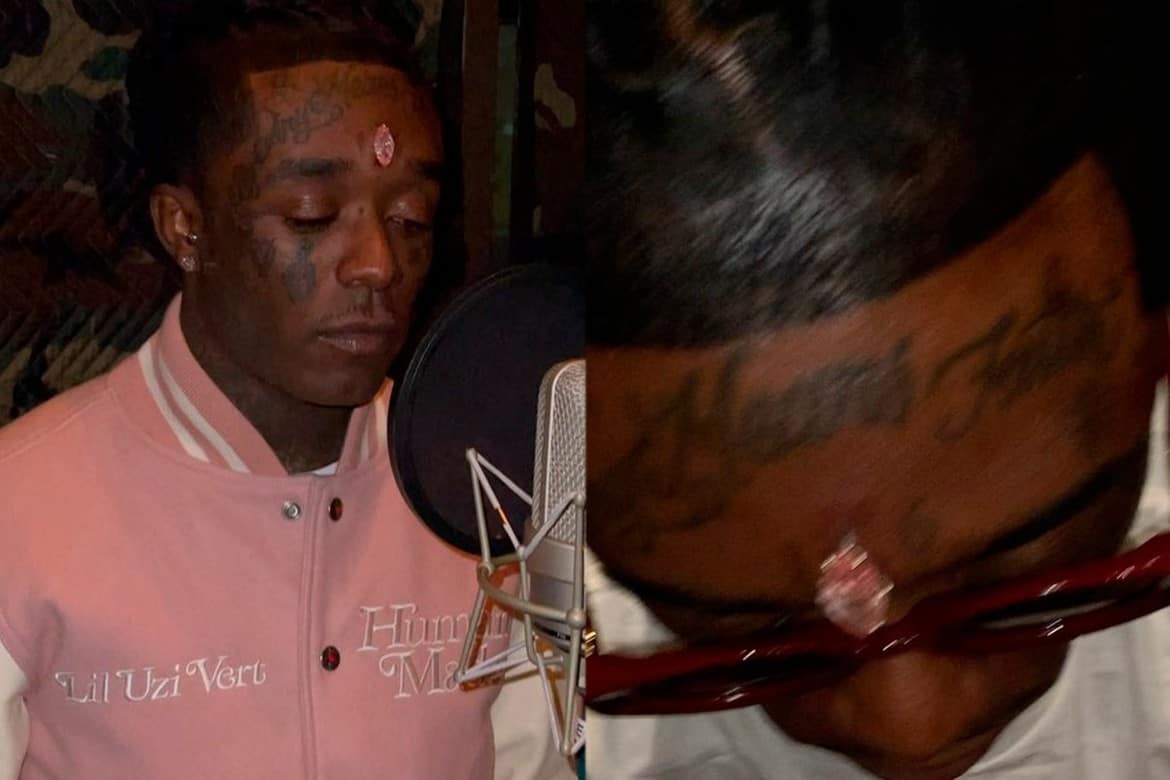 Lil Uzi Vert Gets $24 Million Pink Diamond Imbedded In His Forehead – Videos!
