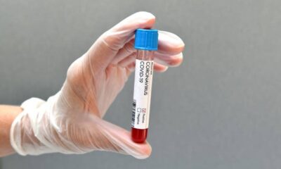 Coronavirus: The Efficacy of Antibody Tests