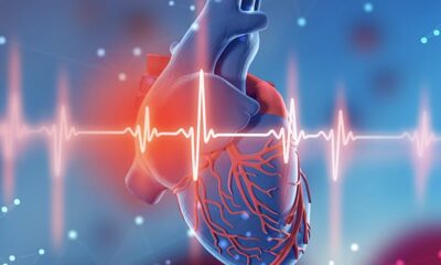 Improve your Patient Care and Business Agility by Techindia‘s Cardiac Rhythm Interpretation Service