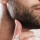 What to Expect Before and After a Beard Transplant
