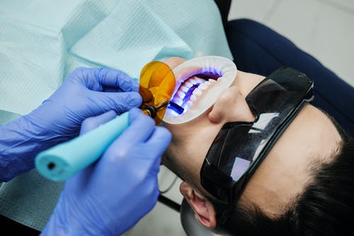 What to Know When Going for a Dental Filling Appointment