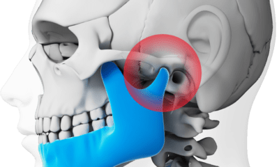 How Can You Treat TMJ Disorders?