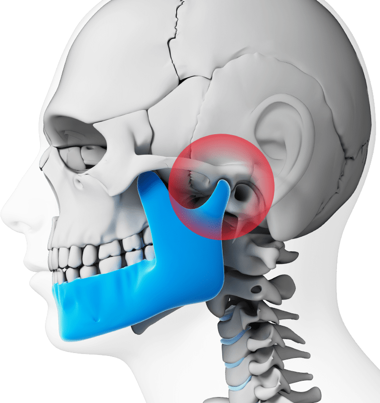 How Can You Treat TMJ Disorders?