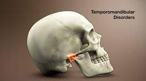 What Causes Temporomandibular Joint Disorders?