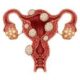 What Are Uterine Fibroids?