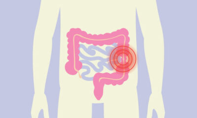 How To Tell If You Have a Colon Issue