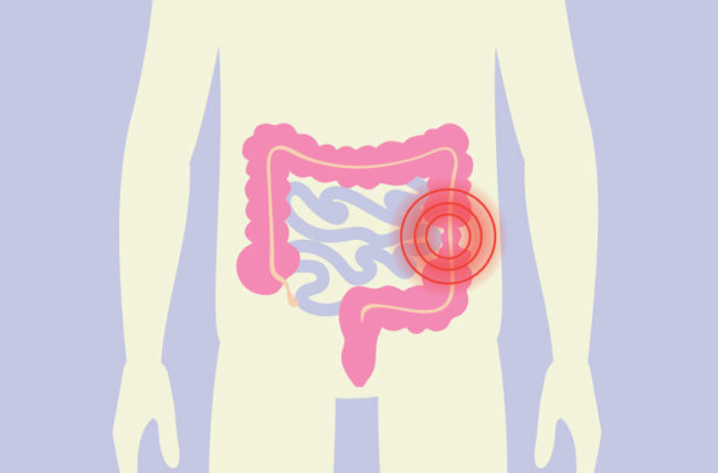 How To Tell If You Have a Colon Issue