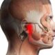 6 Home Remedies to Relieve TMJ Pain