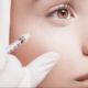 5 FAQs About Botox Treatments Answered
