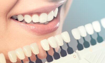 7 Types of Cosmetic Dental Procedures You Can Choose