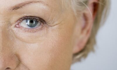 What Causes Wrinkles? A Prevention Guide
