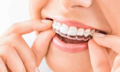 Why Invisalign is the Perfect Teeth Straightening Solution for Teens