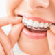 Why Invisalign is the Perfect Teeth Straightening Solution for Teens