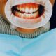 Is Gum Recession Bad?