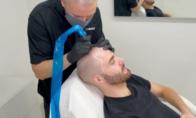 Try a Cosmetic Hair Tattoo for Your Receding Hairline