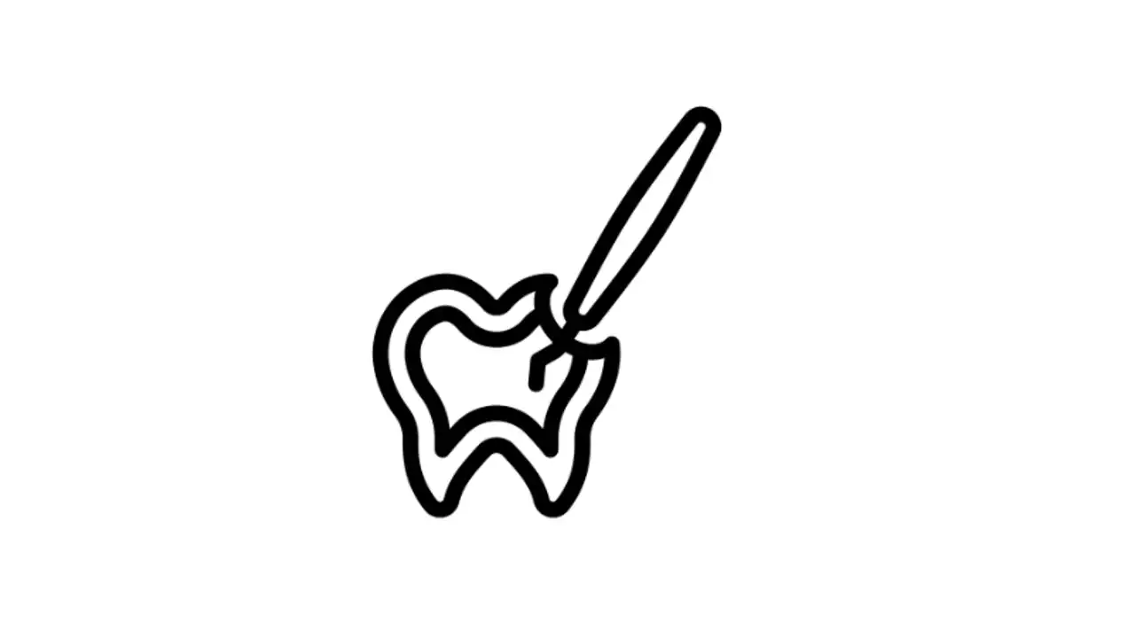 An In-Depth Look at the Root Canal Procedure