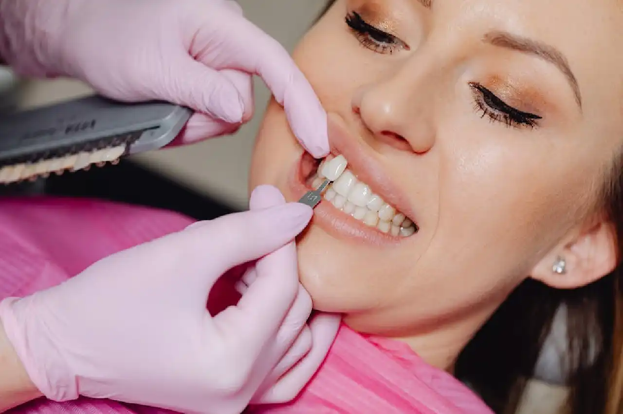 6 Common Errors with Dental Veneer Care and How to Avoid Them