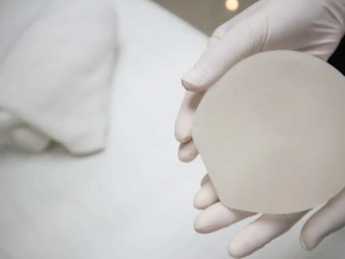 What Is an Encapsulated Breast Implant? Aftercare Tips and Processes
