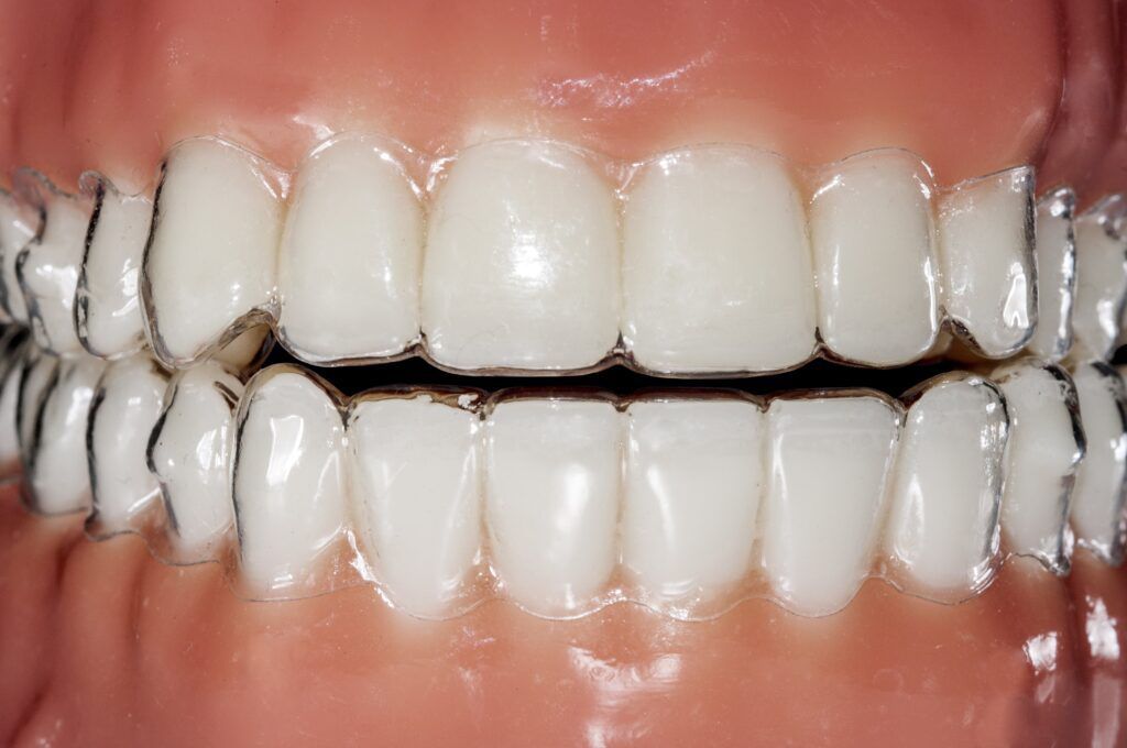 Choosing the Right Orthodontic Treatment: A Comprehensive Guide