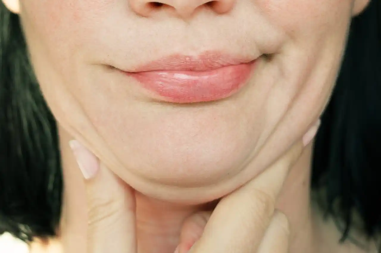 How Much Does Kybella Cost on Average?
