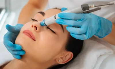 Exploring the Different Types of Facial Laser Treatments Available Near You