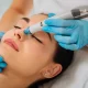 Exploring the Different Types of Facial Laser Treatments Available Near You