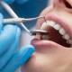 Achieving a Beautiful Smile: Dental Aesthetics and You