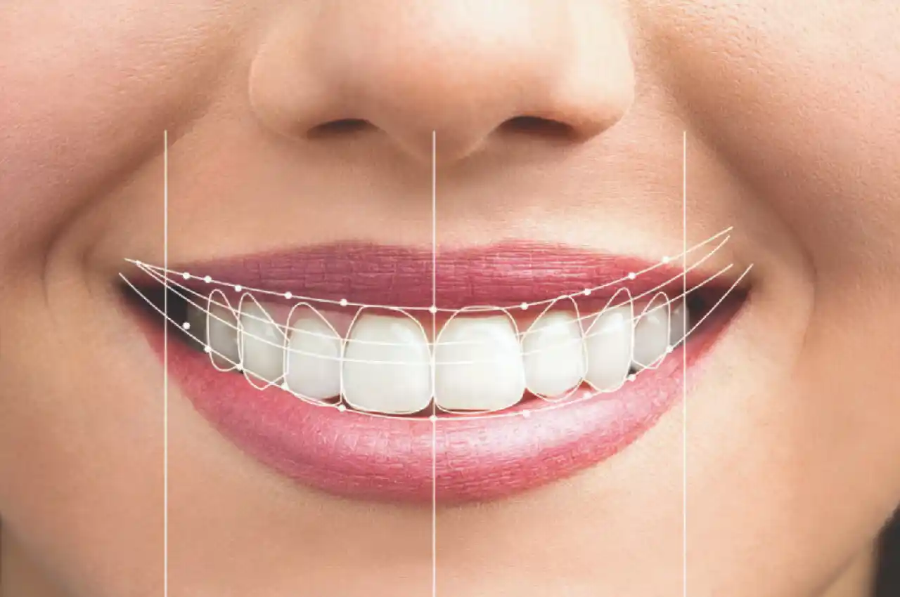Smile Design Dentistry Service: Enhancing Your Smile Aesthetically and Functionally