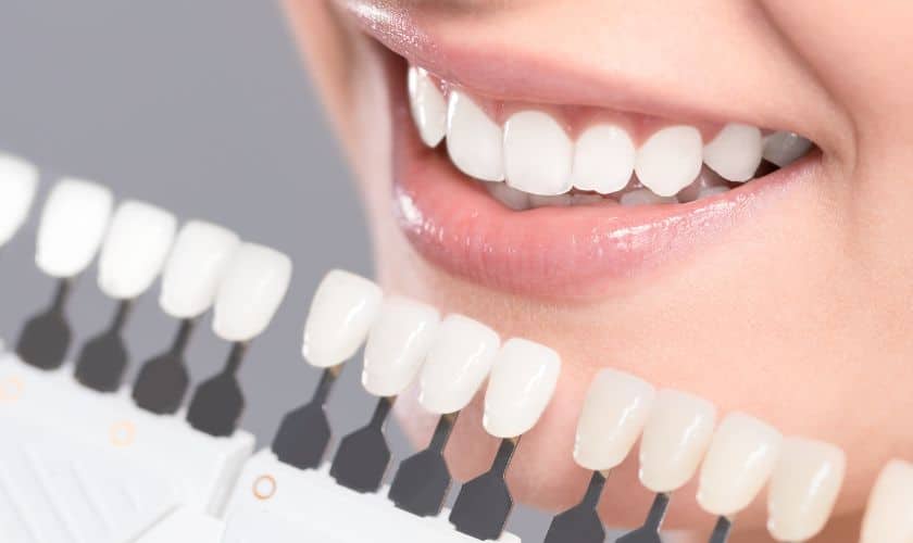 Unlocking the Secrets to a Brighter Smile with Teeth Whitening