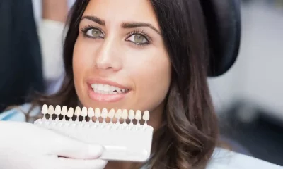 Everything You Need to Know Before Getting Same Day Veneers