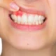 Gum Rejuvenation: How Periodontal Services Can Restore Your Smile