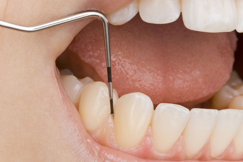 The Power of Deep Teeth Cleaning: How It Can Improve Your Oral Health