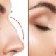 What to Expect: The Recovery Process of Rhinoplasty Before and After Surgery