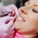 How a Dental Makeover Reconstruction Can Transform Your Smile