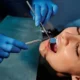 How Regular Check-Ups Contribute to Optimal Dental Care