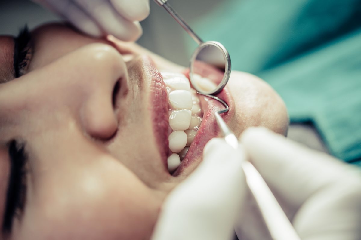 Signs You Might Need a Root Canal: What Your Tooth Is Telling You