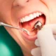 How Do Dental Drill Stoppers Improve Safety?