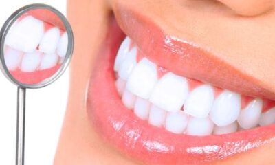 How to Get a Perfect Smile Without Breaking the Bank in Turkey