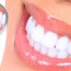 How to Get a Perfect Smile Without Breaking the Bank in Turkey
