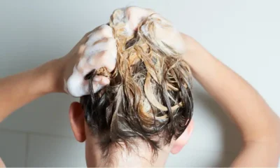 Say Goodbye to Dandruff: Best Anti-Dandruff Shampoos on Quick Grocery Delivery Apps