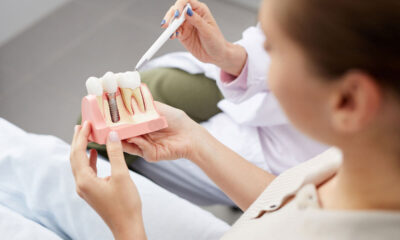 Step-by-Step Guide to Getting a Single Dental Implant