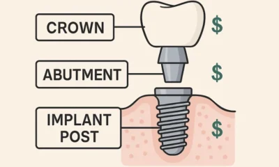 Dental Implant Costs and What Influences Them