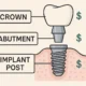 Dental Implant Costs and What Influences Them