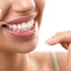 How Daily Habits Shape Oral Health