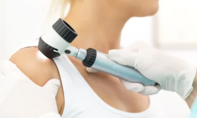Professional Skin Exams vs. Self-Checks