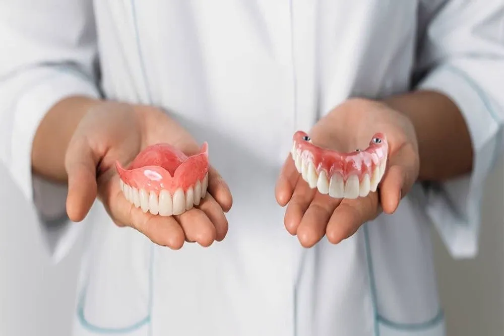 Benefits of Fixed Full Arch Dental Implants Over Traditional Dentures